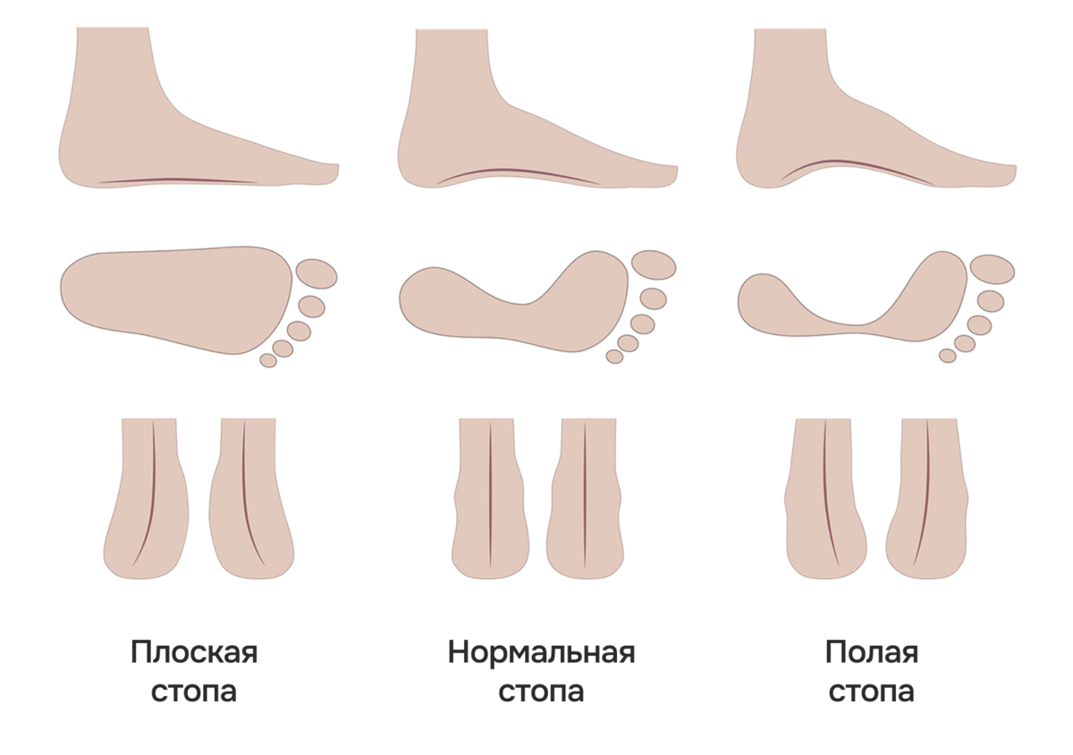 -#0020 {1200x845}: (plantoscope-4.png) [типы стопы]