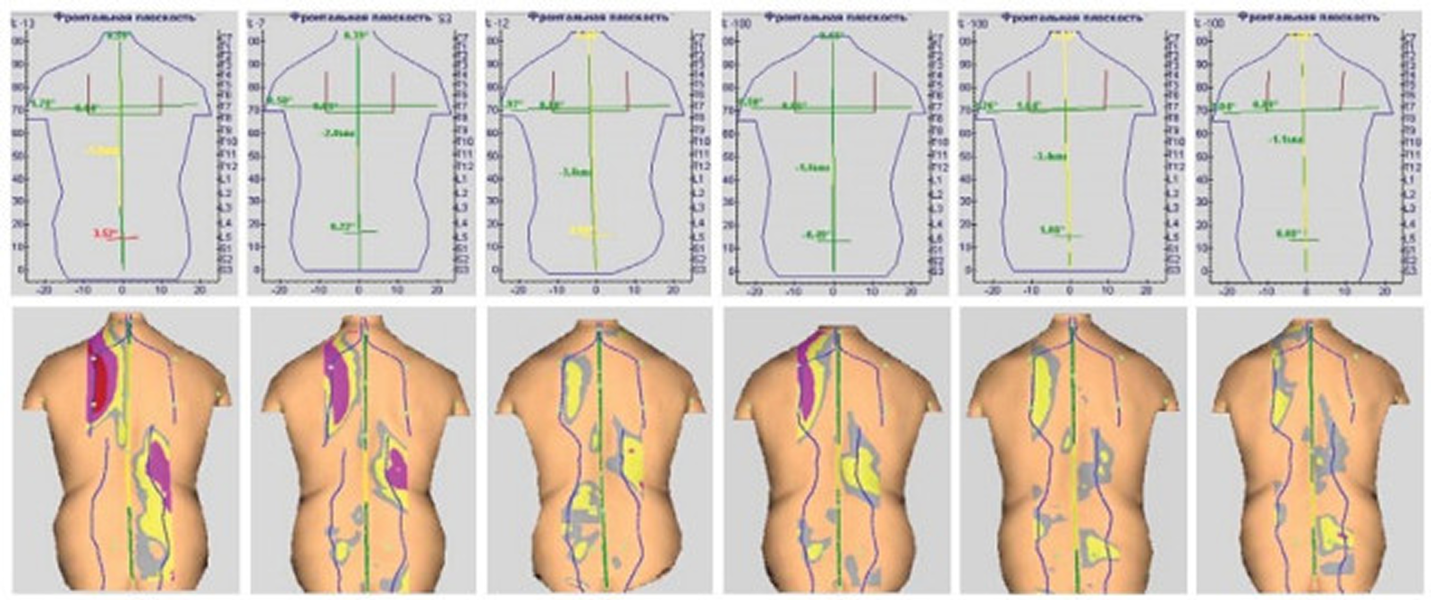 -#0010 {1600x671}: (metos-1.png) 