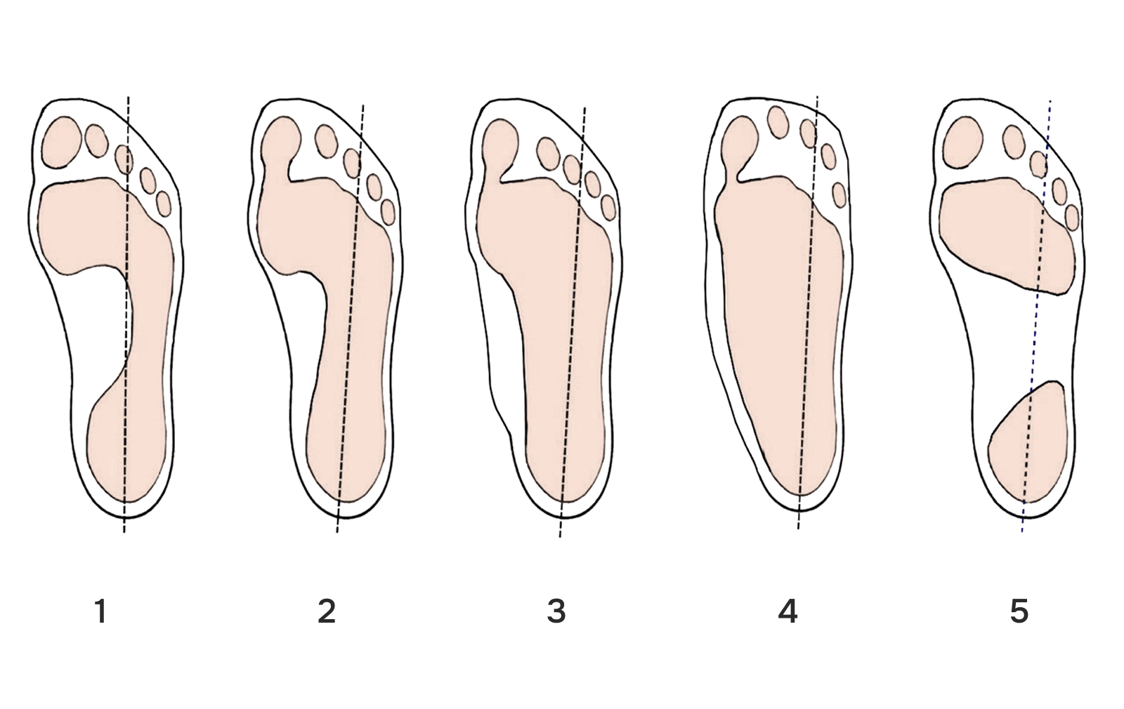 -#0010 {1600x1010}: (plantoscope-5.png) [типы плоскостопия]