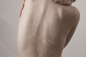 ТОП-5 вопросов про сколиоз